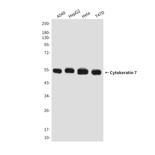 Cytokeratin 7 Mouse Monoclonal Antibody