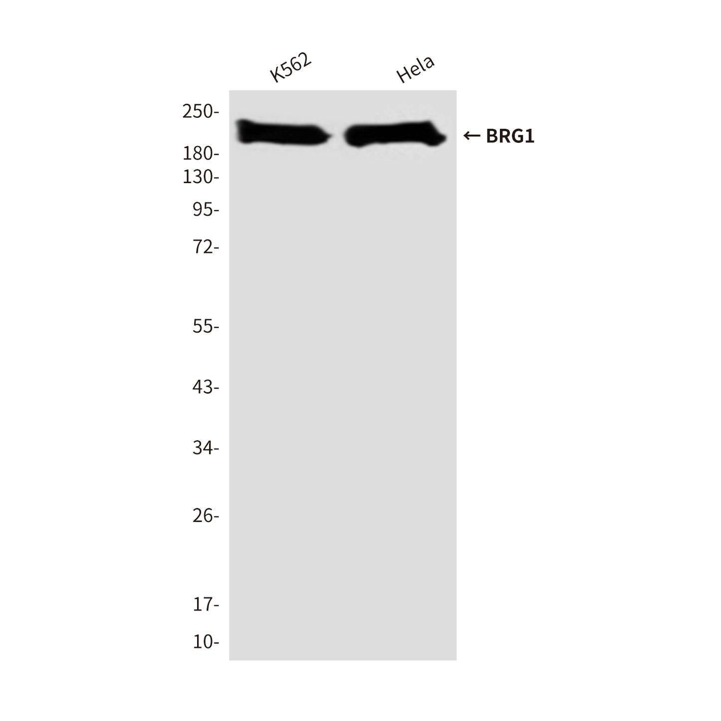BRG1 (4E11) Mouse Monoclonal Antibody