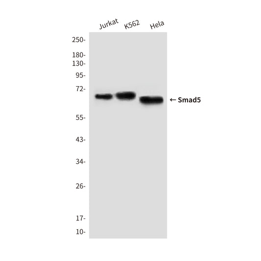 Smad5 (4B10) Mouse Monoclonal Antibody