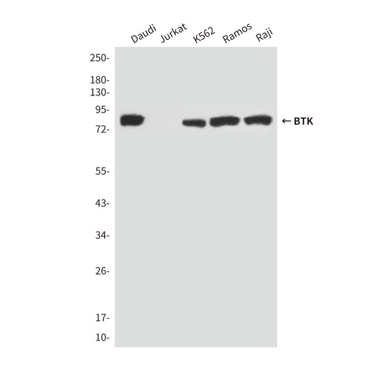 BTK (5B12) Mouse Monoclonal Antibody