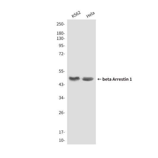 beta Arrestin 1 (6A1) Mouse Monoclonal Antibody