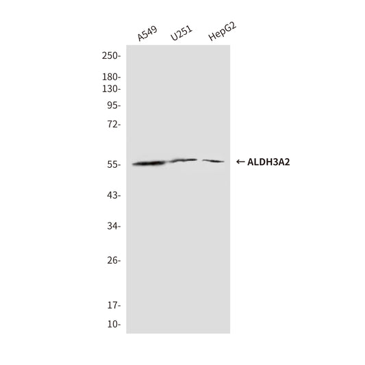 ALDH3A2 (3F7) Mouse Monoclonal Antibody