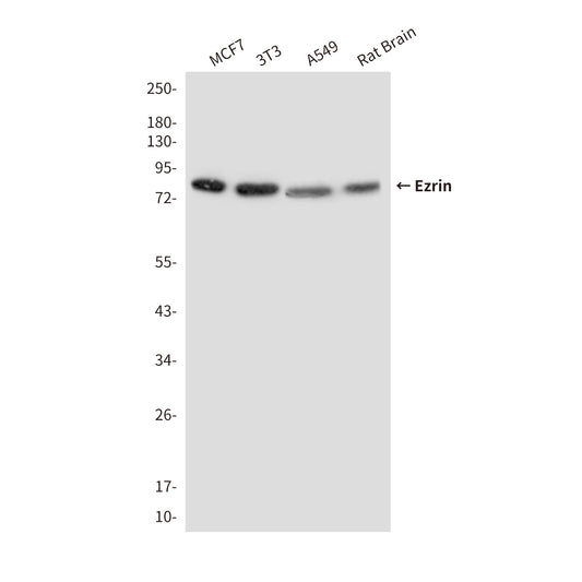 Ezrin (2C12) Mouse Monoclonal Antibody