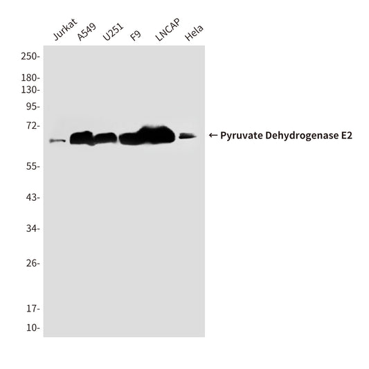 Pyruvate Dehydrogenase E2 (4A4) Mouse Monoclonal Antibody