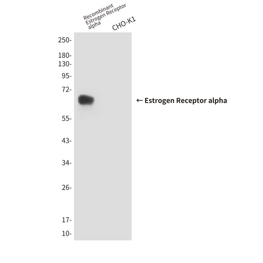 Estrogen Receptor alpha (6F11) Mouse Monoclonal Antibody
