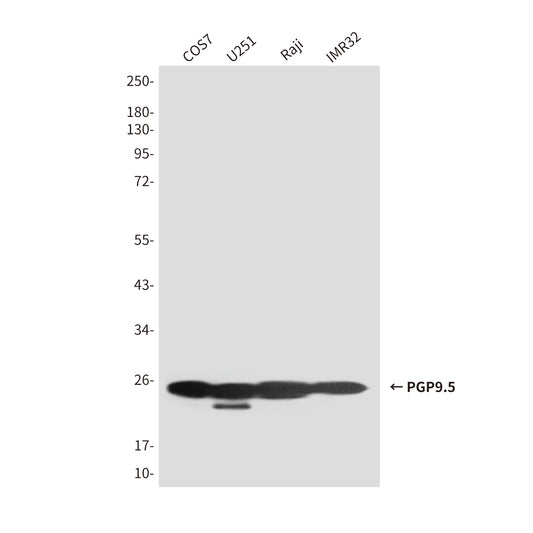 PGP9.5 (7B8) Mouse Monoclonal Antibody