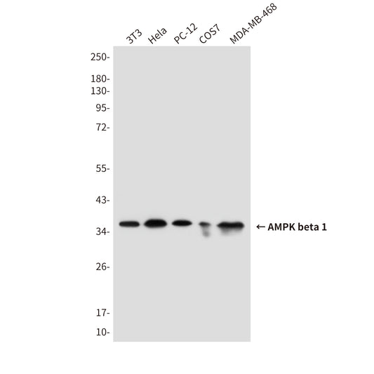AMPK beta 1 (1A7) Mouse Monoclonal Antibody