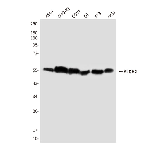 ALDH2 (8D4) Mouse Monoclonal Antibody