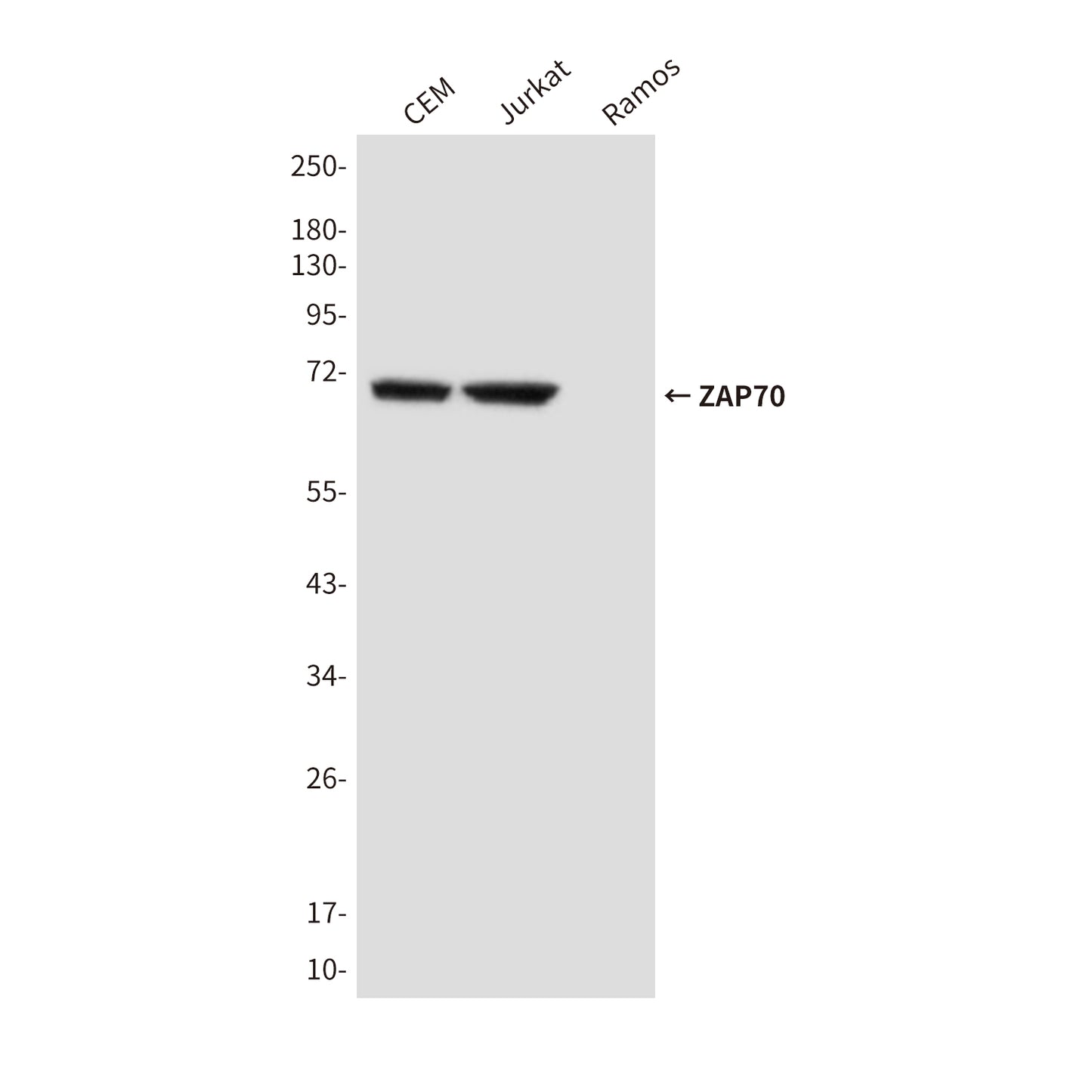 ZAP70 (4B2) Mouse Monoclonal Antibody