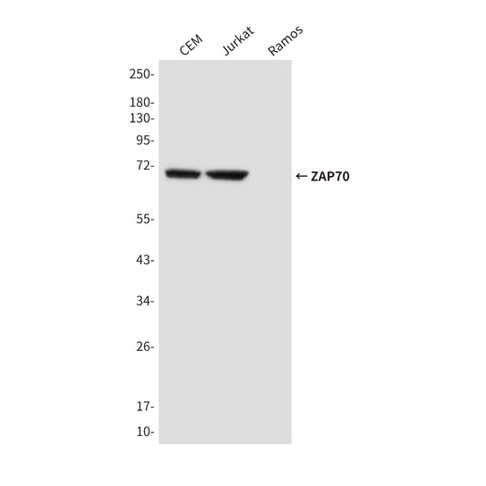 ZAP70 (4B2) Mouse Monoclonal Antibody