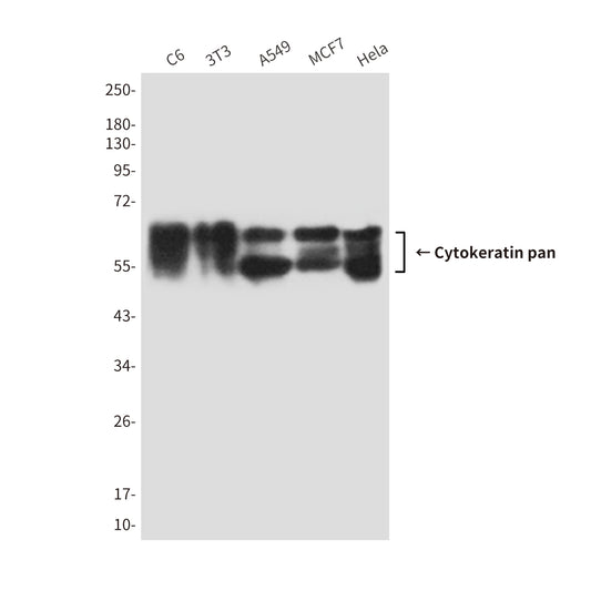 Cytokeratin pan (7H5) Mouse Monoclonal Antibody