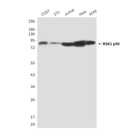 RSK1 p90 (6B9) Mouse Monoclonal Antibody