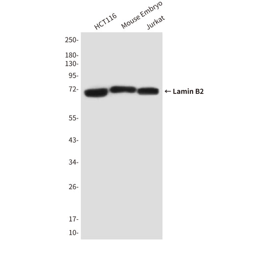 Lamin B2 (8F6) Mouse Monoclonal Antibody