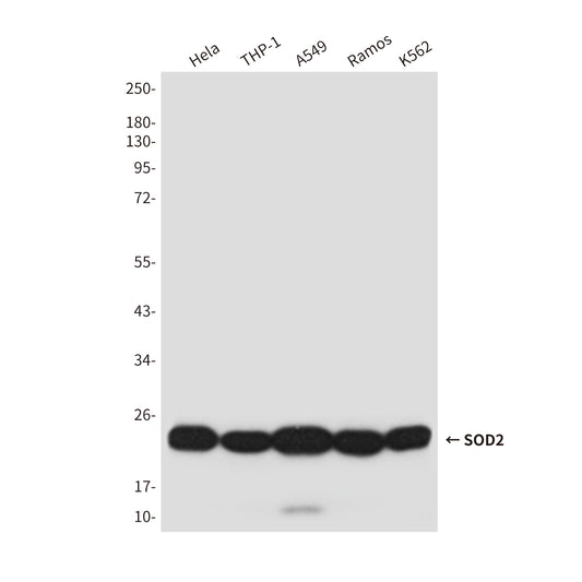 SOD2 (4C4) Mouse Monoclonal Antibody