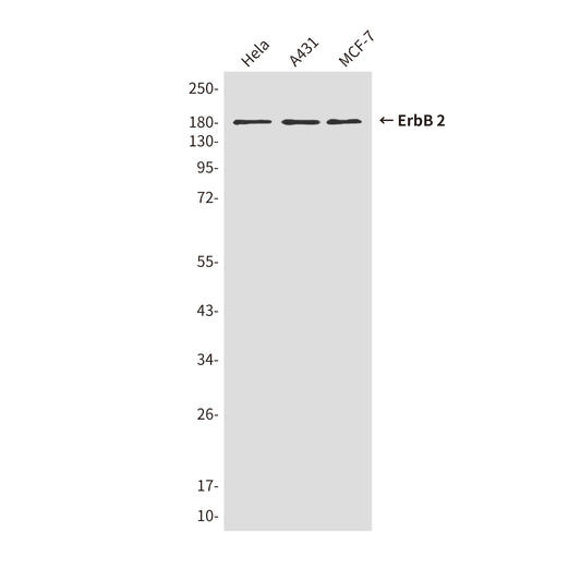 ErbB 2 (1C4) Mouse Monoclonal Antibody