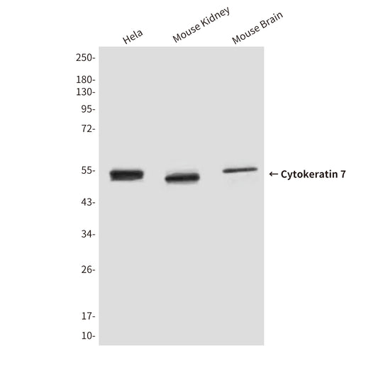 Cytokeratin 7 (9G9) Mouse Monoclonal Antibody