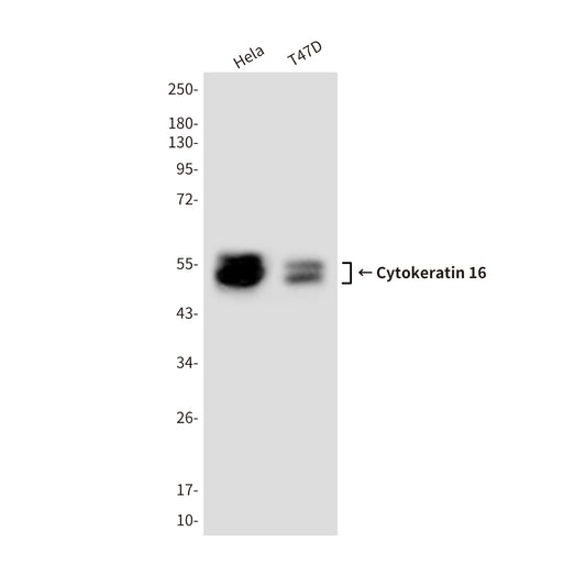 Cytokeratin 16 (10C7) Mouse Monoclonal Antibody