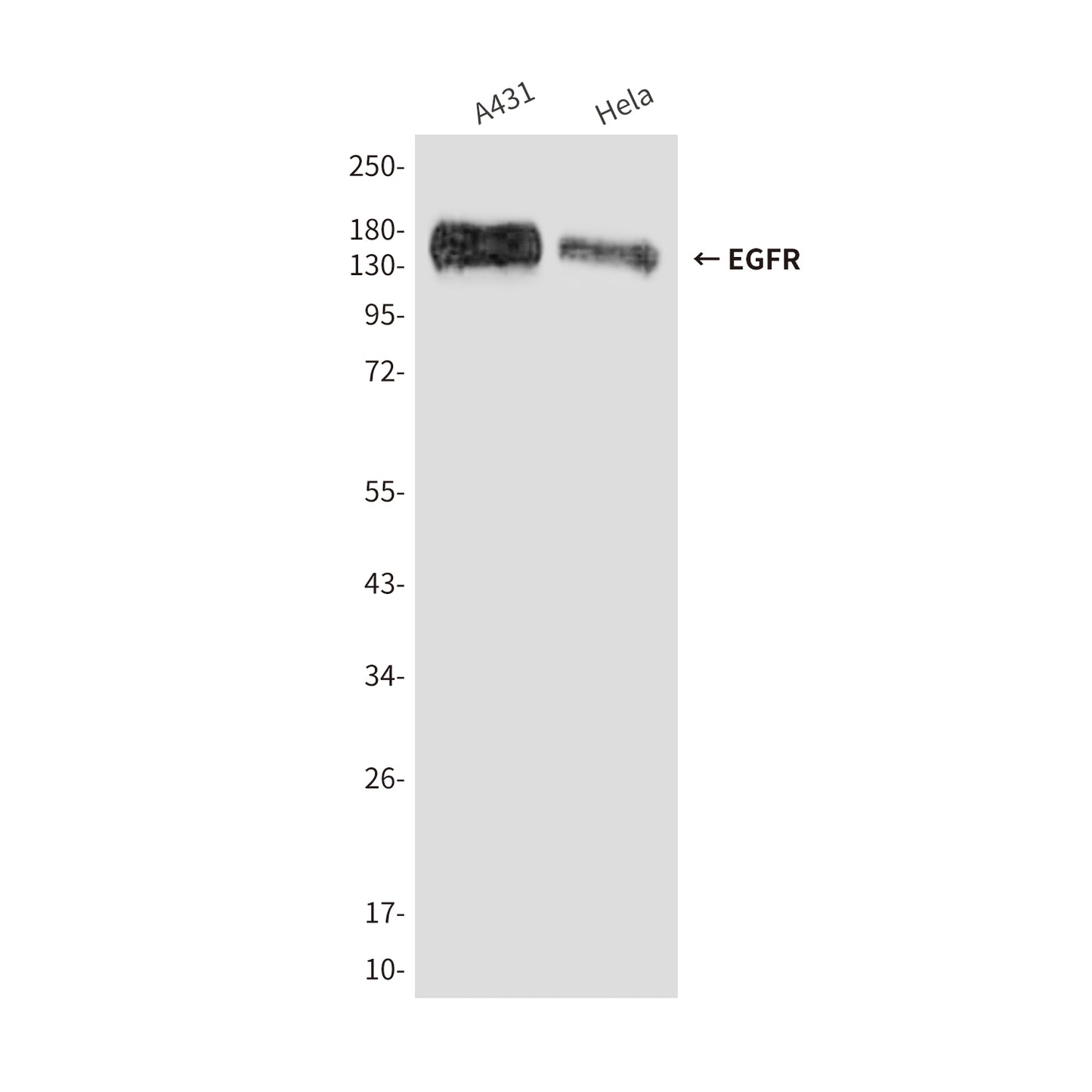 EGFR (5E9) Mouse Monoclonal Antibody