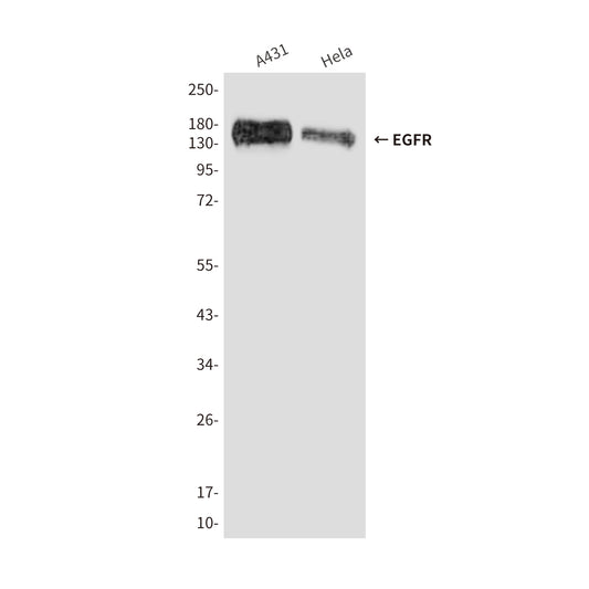 EGFR (5E9) Mouse Monoclonal Antibody