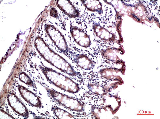 HP1 gamma (6D8) Mouse Monoclonal Antibody