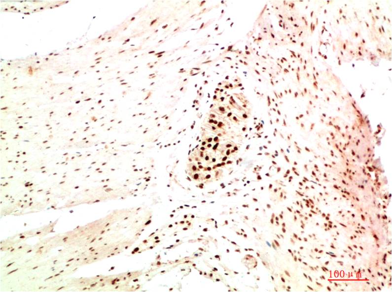 HP1 alpha (1E8) Mouse Monoclonal Antibody