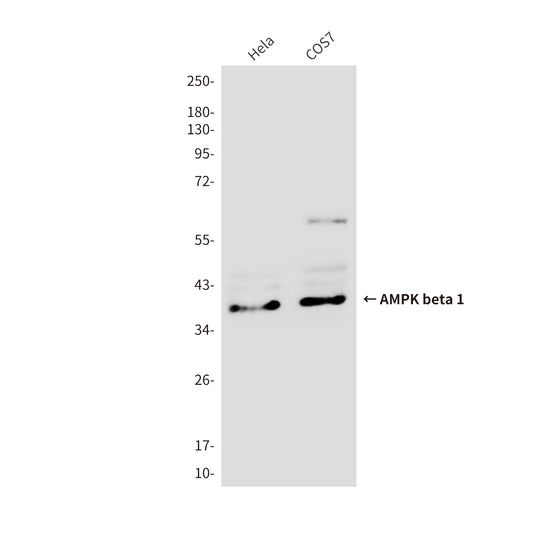 AMPK beta 1 Mouse Monoclonal Antibody