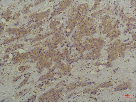 ERK1/2 (9A4) Mouse Monoclonal Antibody