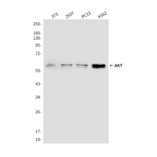 AKT Mouse Monoclonal Antibody