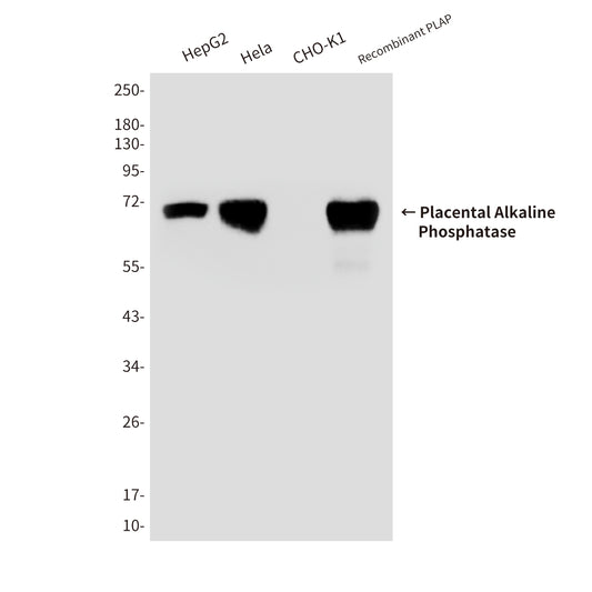 Placental Alkaline Phosphatase Mouse Monoclonal Antibody