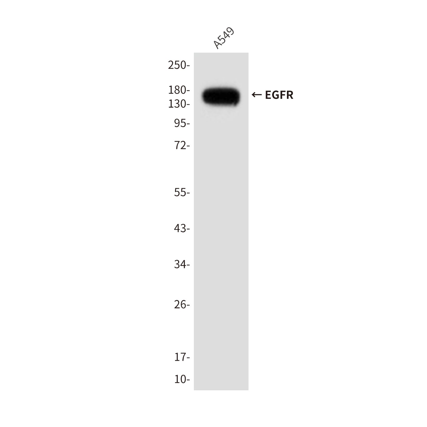 EGFR (1A11) Mouse Monoclonal Antibody