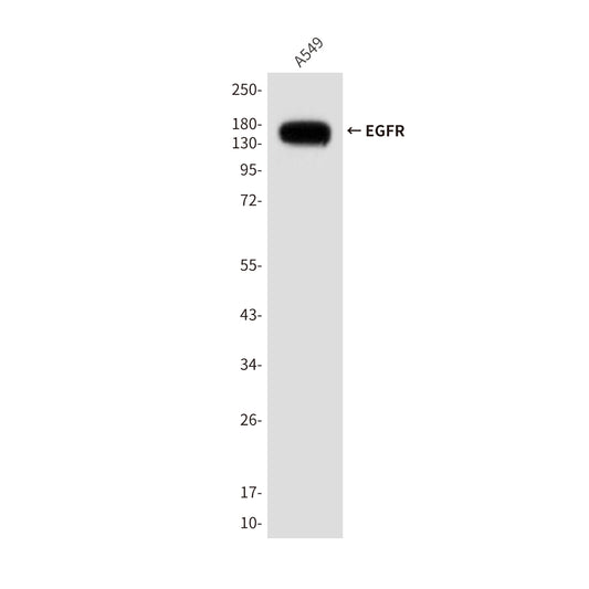 EGFR (1A11) Mouse Monoclonal Antibody