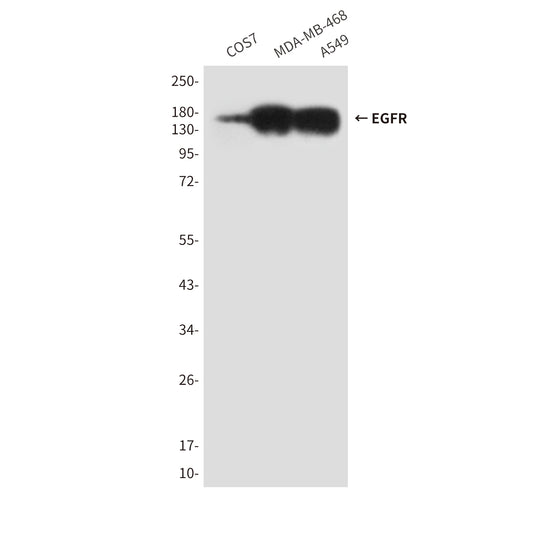 EGFR (5E10) Mouse Monoclonal Antibody