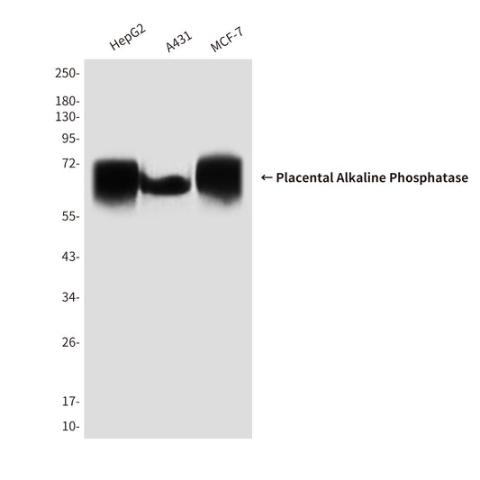 Placental Alkaline Phosphatase Mouse Monoclonal Antibody