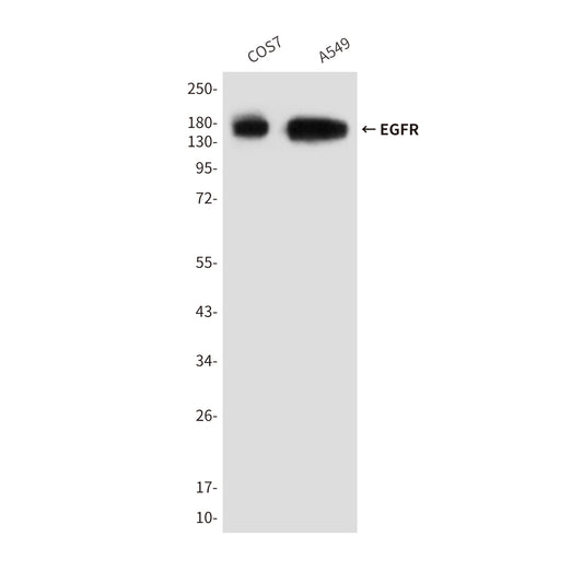 EGFR (6H11) Mouse Monoclonal Antibody