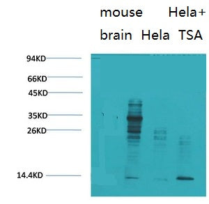 Acetyl Lysine(10B10)Mouse Monoclonal Antibody
