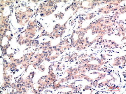 Acetyl-Histone H3(K9)(2E7)Mouse Monoclonal Antibody