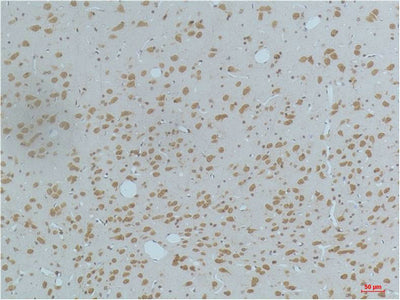 CaMKIIβ/γ/δ(Phospho Thr287)(4H2)Mouse Monoclonal Antibody