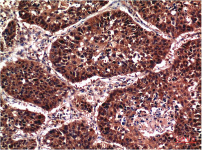 Phospho-Akt(S473)(7F9)Mouse Monoclonal Antibody
