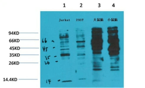 Phosphotyrosine(2C1)Mouse Monoclonal Antibody