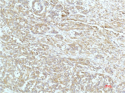 a-actinin(4A12)Mouse Monoclonal Antibody