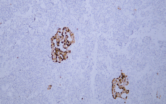 Chromogranin A (ABT037) Mouse Monoclonal Antibody