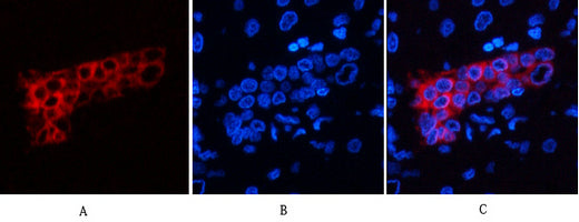 CK7(12D7)Mouse Monoclonal Antibody