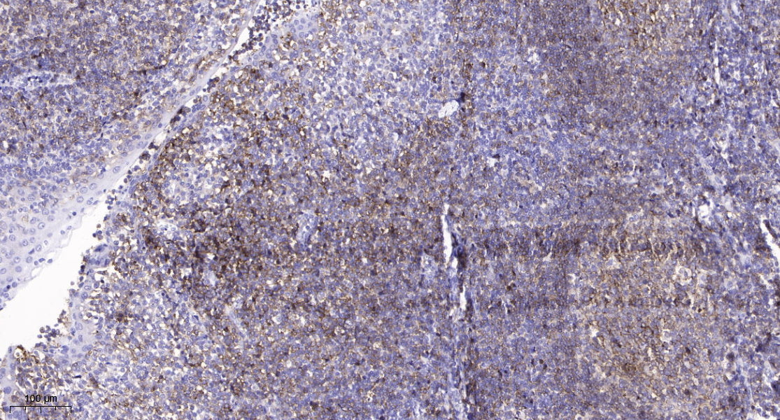 Claudin-2 Mouse Monoclonal Antibody(8H11)