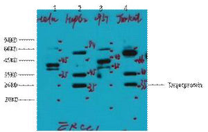 ERCC1(1B10)Mouse Monoclonal Antibody