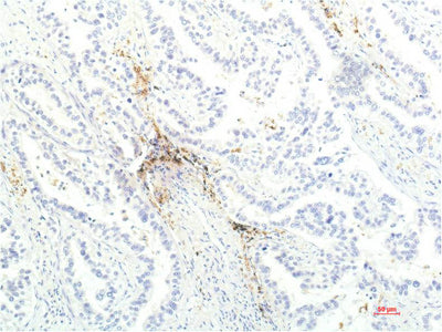 JAK1(7G6)Mouse Monoclonal Antibody