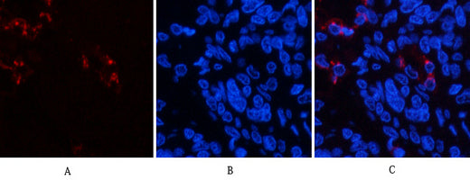 Lactoferrin(Q100)Mouse Monoclonal Antibody