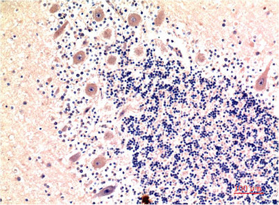 LC3B(9H5)Mouse Monoclonal Antibody
