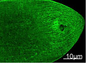Myosin Heavy Chain(11C2)Mouse Monoclonal Antibody