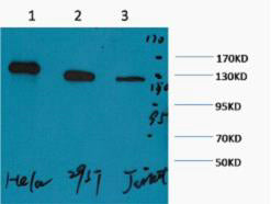 PARP(M3)Mouse Monoclonal Antibody