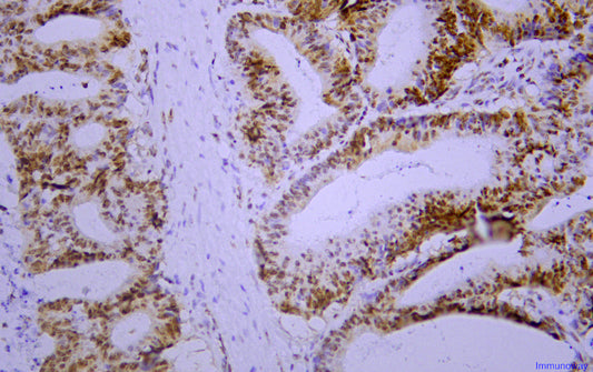 Postmeiotic Segregation Increased 2(PMS2)(PT2116)Mouse Monoclonal Antibody